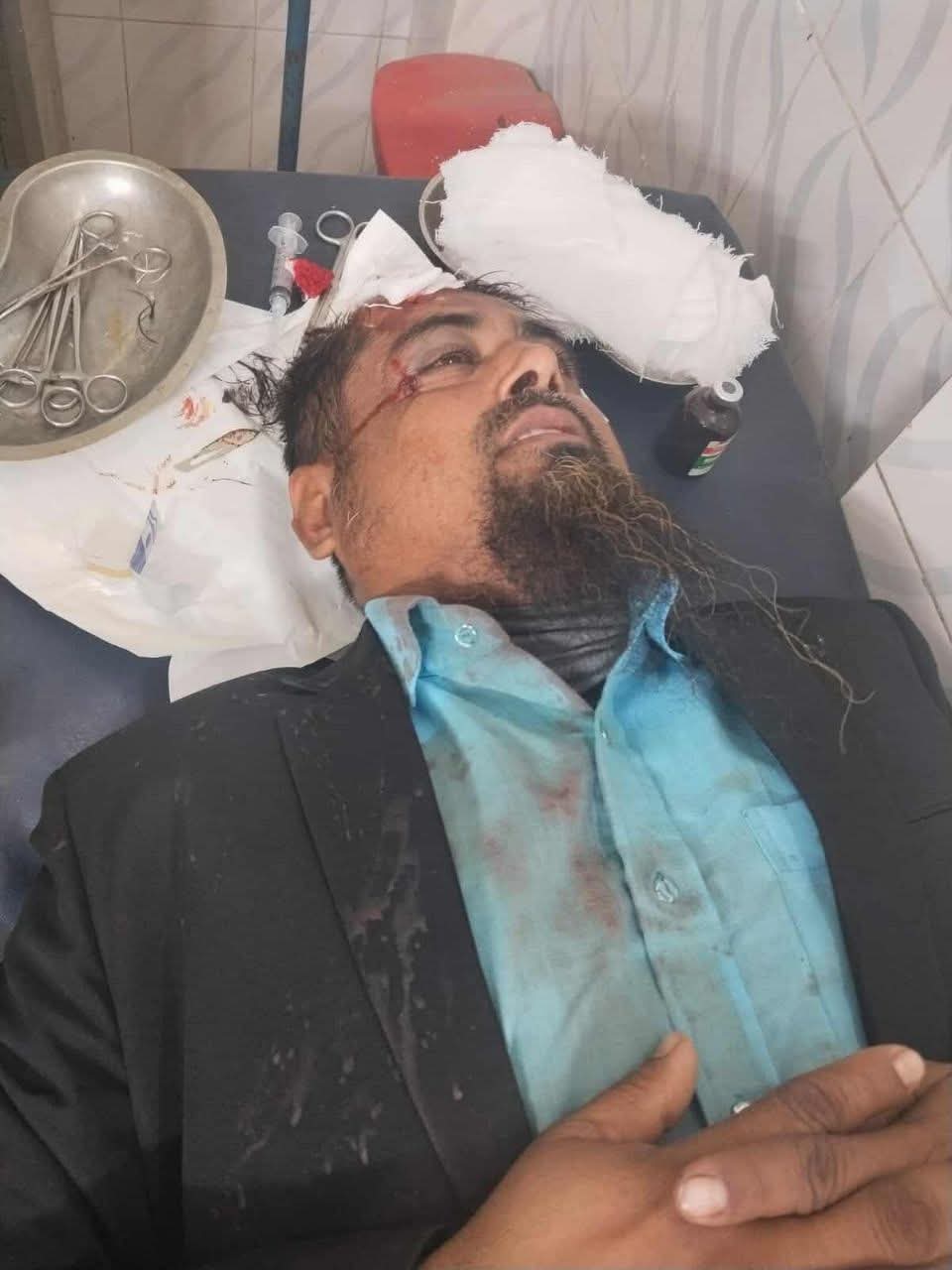 বাগমারায় জামায়াত কর্মীকে কুপিয়ে জখম