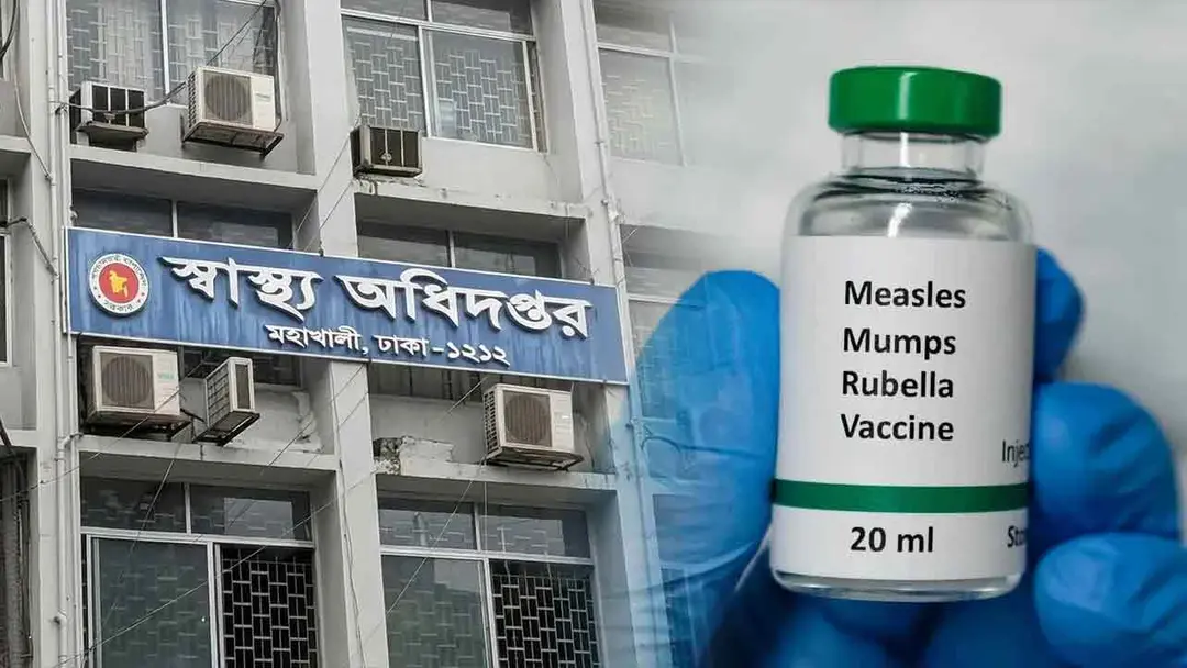 হাম ও হামের উপসর্গ নিয়ে আরও ১১ শিশুর মৃত্যু